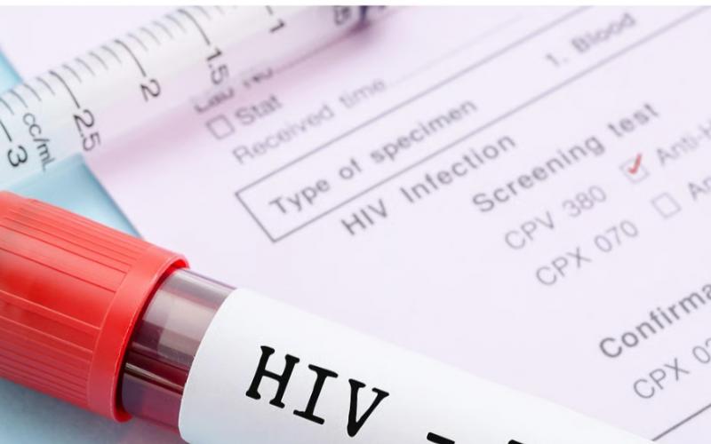 57 HIV infected patients found in Raigarh, health department on alert mode latest News Latest big News khabargali 