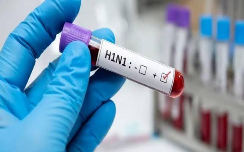 Swine flu cases surge; 10 new patients detected at once, taking the total count to 115. raipur hindi news khabargali 