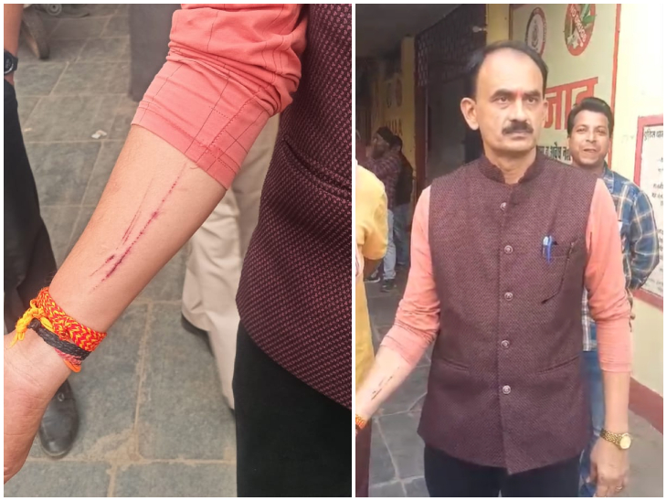 BJP councilor Rohit Sahu and BJP slum cell district president Om Rathod fight over road tender, Rathod suffers serious nose injury, Raipur, Chhattisgarh, Khabargali