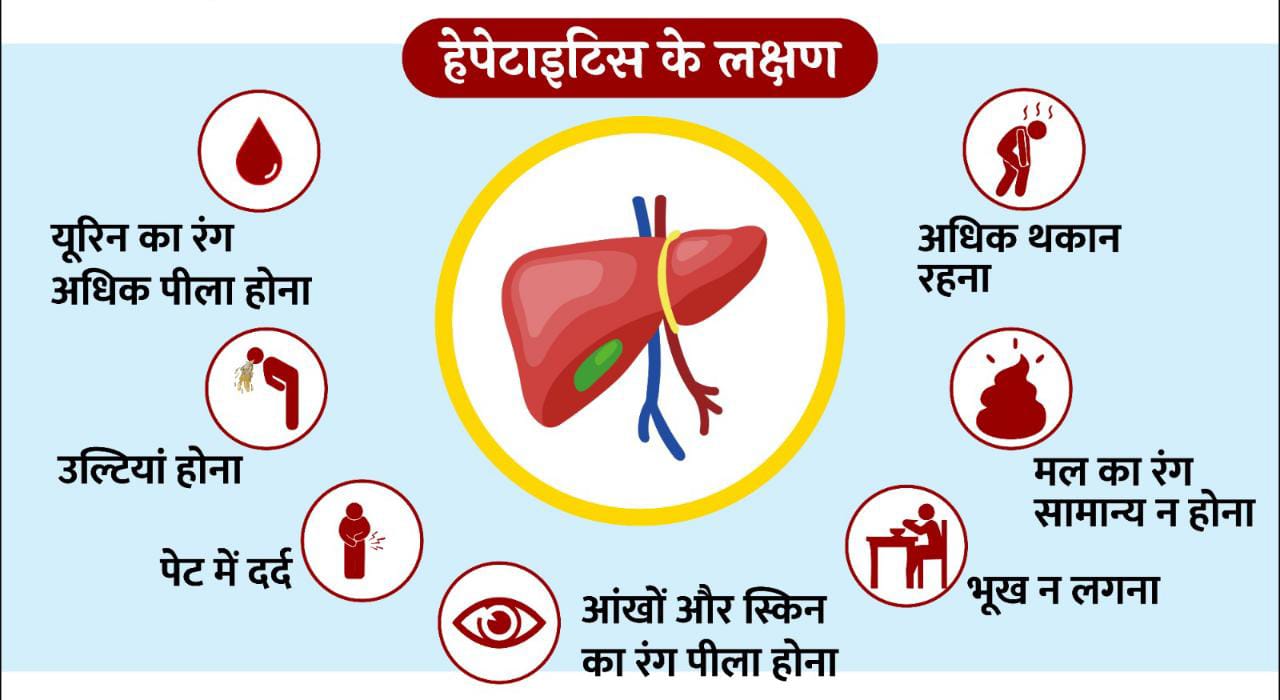 Know what is Hepatitis, Jaundice, its types, symptoms and diagnosis, virus, liver, Dr. Mahavir Agarwal, MBBS MD, Medicine Specialist, Khabargali