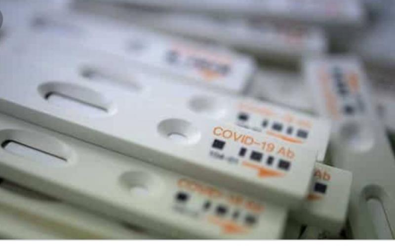 Covid-19 testing kits for corona , Commissioner of Health Department, Dr. C.R. Prasanna,Health Department , chhattisgarh, khabargali 