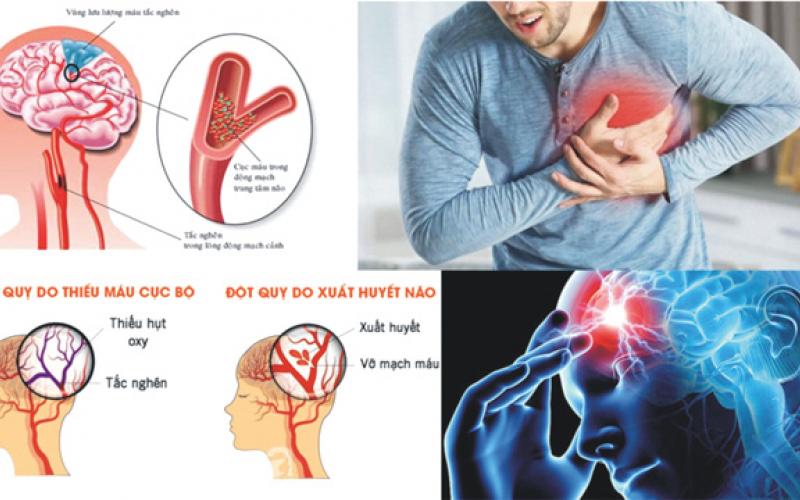 Paralysis, brain stroke, heart attack, Pharmaz has made this medicine called Tyvalzi, Sun Pharma will distribute it all over India, Khabargali