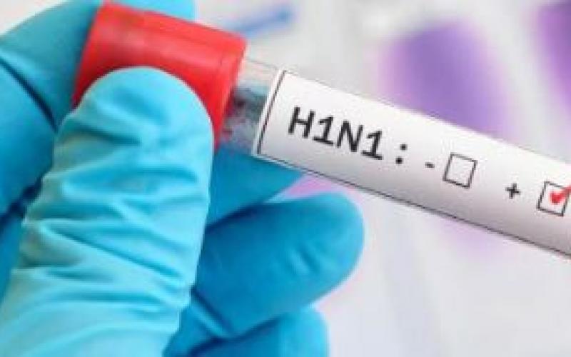 Swine flu hits the state, 2 women die, 7 new infected... latestnews hindinews cgnews bignews khabargali