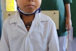 Children are getting new life from Chirayu Yojana, Thalassemia, Splenomegaly, Chhattisgarh,khabargali