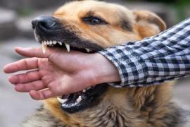 If dog bites, compensation fixed at Rs 10,000 for each tooth mark, if flesh is scratched, double compensation... 1.6 crore cases of dog bites registered in India in 3 years, rabies, news,khabargali