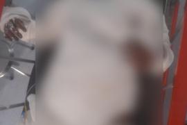 A girl committed suicide by setting herself on fire at the railway station, RPF jawans took her to the hospital... Cg news big news hindi news khabargali 