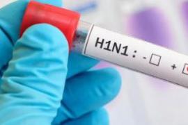 Swine flu hits the state, 2 women die, 7 new infected... latestnews hindinews cgnews bignews khabargali