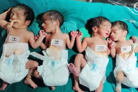 धमतरी में अनोखा मामला, एक महिला ने चार बच्चो को दिया जन्म खबरगली Unique case in Dhamtari, a woman gave birth to four children  cg news cg big news hindi news dhamatari news cg latest news khabargali 