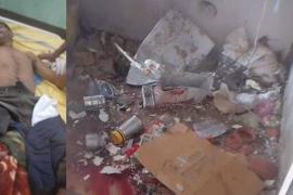 The fridge exploded like a bomb as soon as the door was opened... both legs were blown off, life was lost Khabargali Alert: Know the main reasons for fridge blast, Chhuikhadan, Chhattisgarh, Khabargali