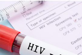 57 HIV infected patients found in Raigarh, health department on alert mode latest News Latest big News khabargali 