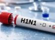 Swine flu outbreak intensifies in Chhattisgarh; over 80 patients reported in 3 days, with more than 50 active cases in Raipur. Hindi news latest news khabargali 