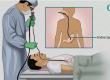 Urmila Hospital, Raipur, Bhatagaon, Endoscopy, GERD, Health News, Free Checkup Camp, Chhattisgarh, Khabargali