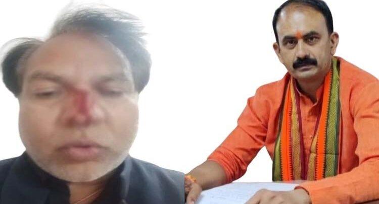 BJP councilor Rohit Sahu and BJP slum cell district president Om Rathod fight over road tender, Rathod suffers serious nose injury, Raipur, Chhattisgarh, Khabargali