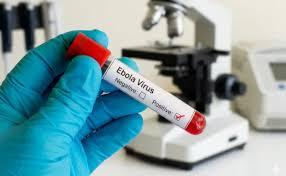  Ebola virus kills 220, DGCA issues new guidelines, Chhattisgarh on high alert new delhi hindi news khabargali 