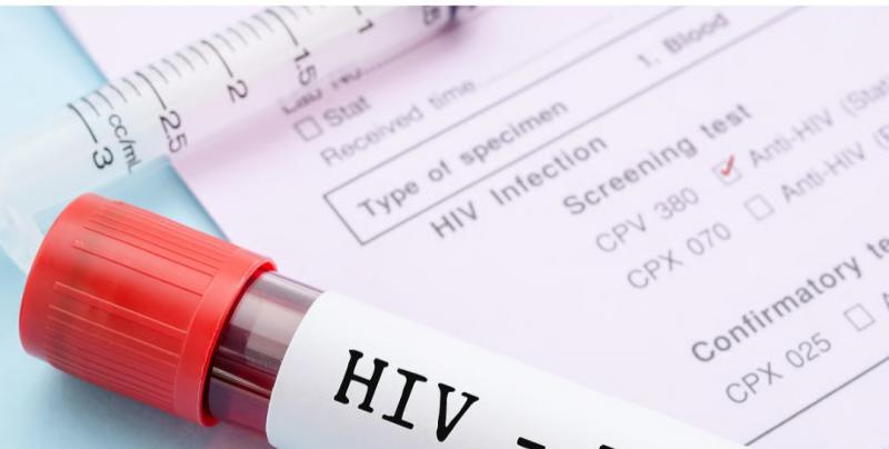57 HIV infected patients found in Raigarh, health department on alert mode latest News Latest big News khabargali 