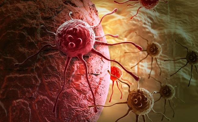 Chhattisgarh's new plan in the fight against cancer: patient database to be created, 5,000-bed 'Medicity' also ready. Latest news hindi news raipur news khabargali 