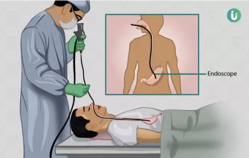 Urmila Hospital, Raipur, Bhatagaon, Endoscopy, GERD, Health News, Free Checkup Camp, Chhattisgarh, Khabargali
